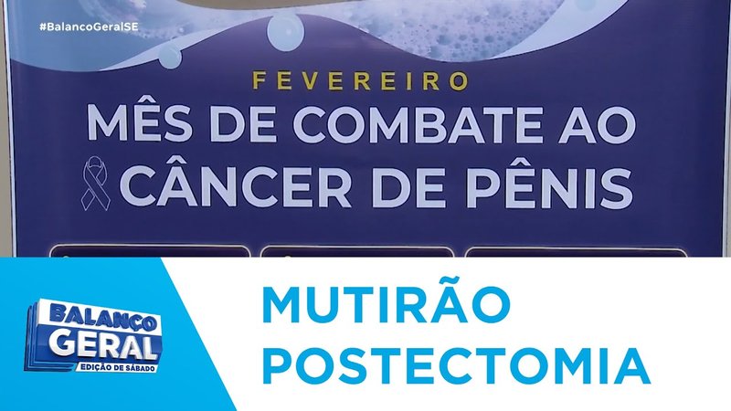  Sociedade Brasileira de Urologia Seccional Sergipe realiza mutirão de postectomia em Aracaju – A8SE.com