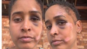  Mulher agredida em lanchonete de Aracaju cria vaquinha solidária – A8SE.com